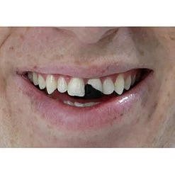 Rubies Costume Co. Inc Tooth Wax